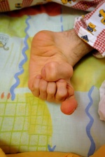 Six toes; One of the rare birth irregularities.
Center for Nursing Children (‘‘KE.PE.P‘‘) in the small city of Lehena. Ileia prefecture, Southwest Greece.
 © Maro Kouri