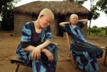 The two albino survivors: 16 year old Semeni and 12 year old Sida, outside their hut in Segerema. In February 2009, five assassins invaded their hut and cut off the limbs of their 14 year old sister, Unis Luguisha who died.
Mwanza, Tanzania, Africa


 © Maro Kouri