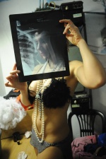 Stripper Anna Dallas holds the radiography of her shoulder that changed position while she was dancing on the pole (http://www.protagon.gr/?i=protagon.el.fwtografia&lid=4608)
 © Maro Kouri